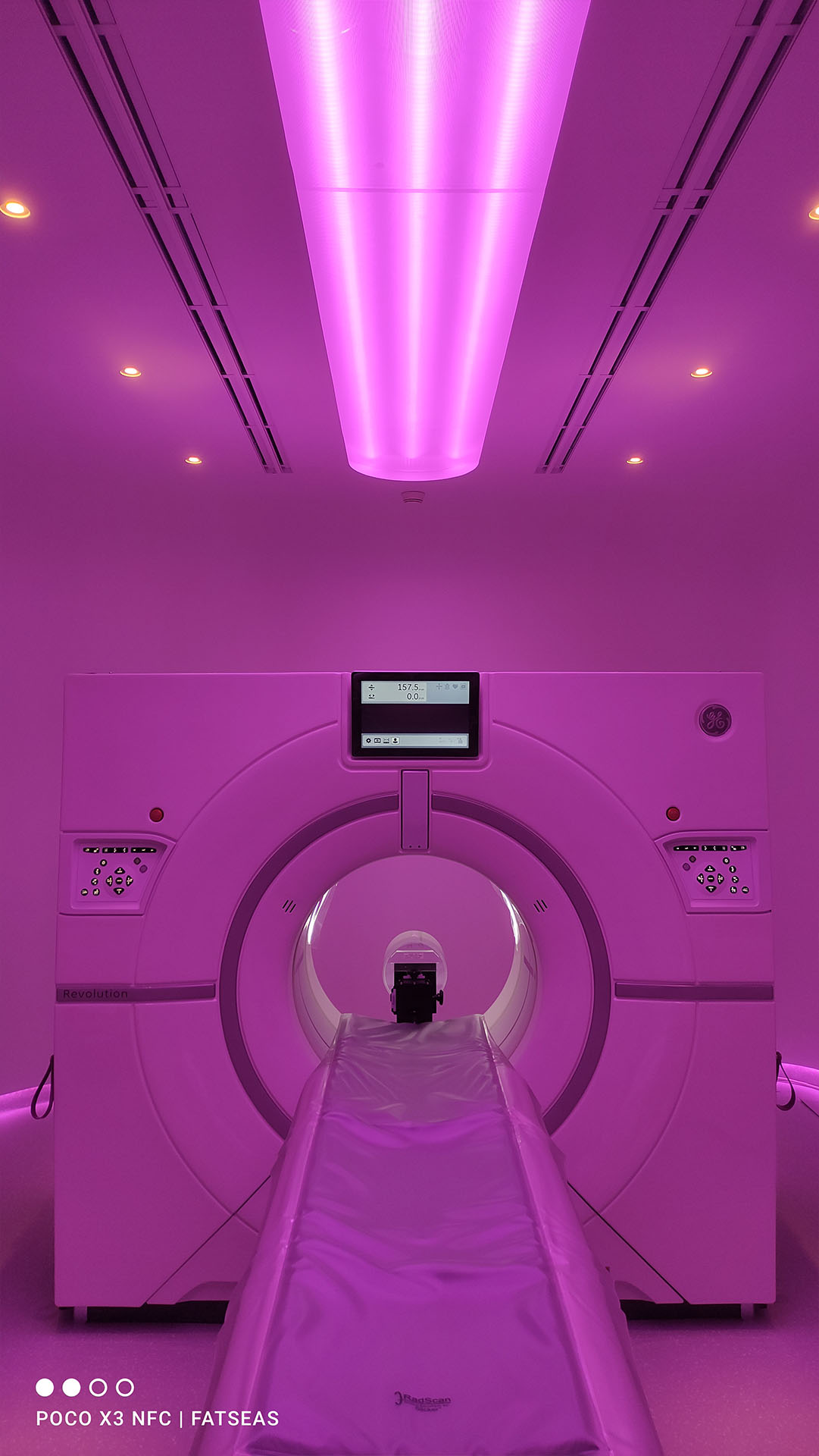 CT Scan Revolution